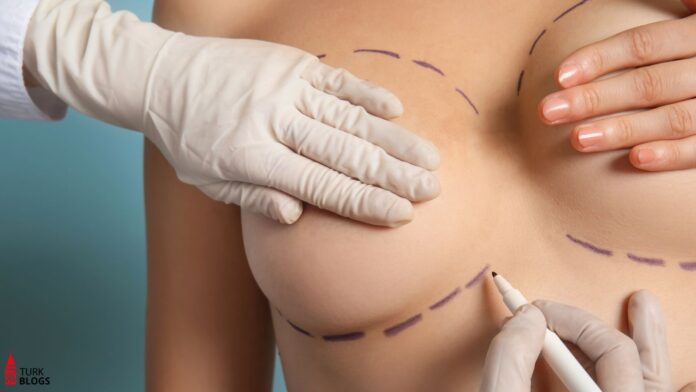 Every Thing About Breast Augmentation in Turkey