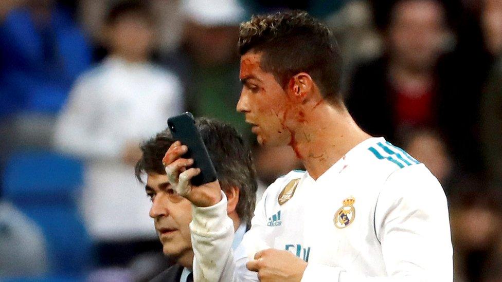 Challenges and Sacrifices in Ronaldo's Career with Real Madrid